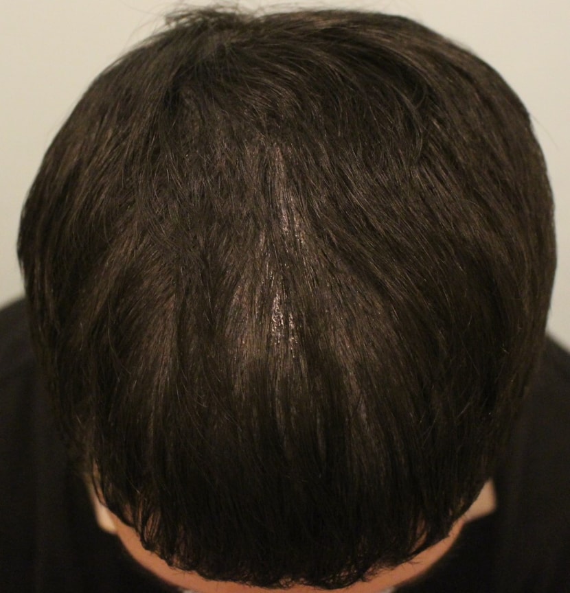 현재