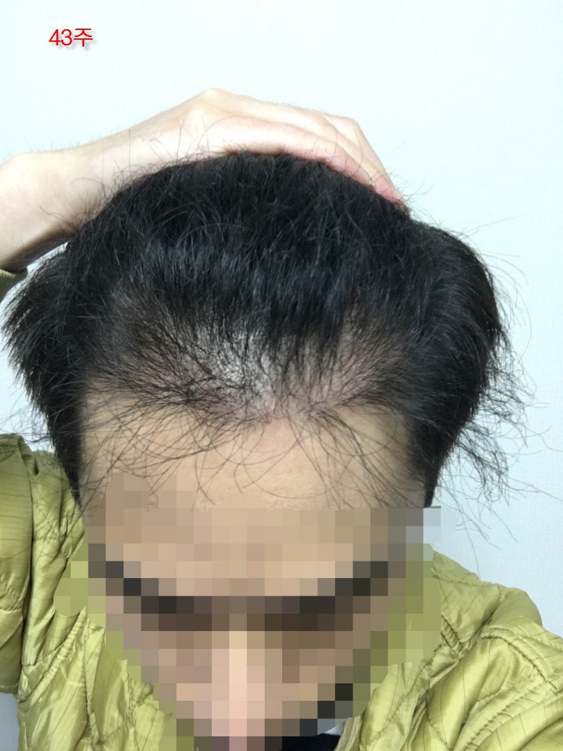 301일째(오늘 10월 26일)