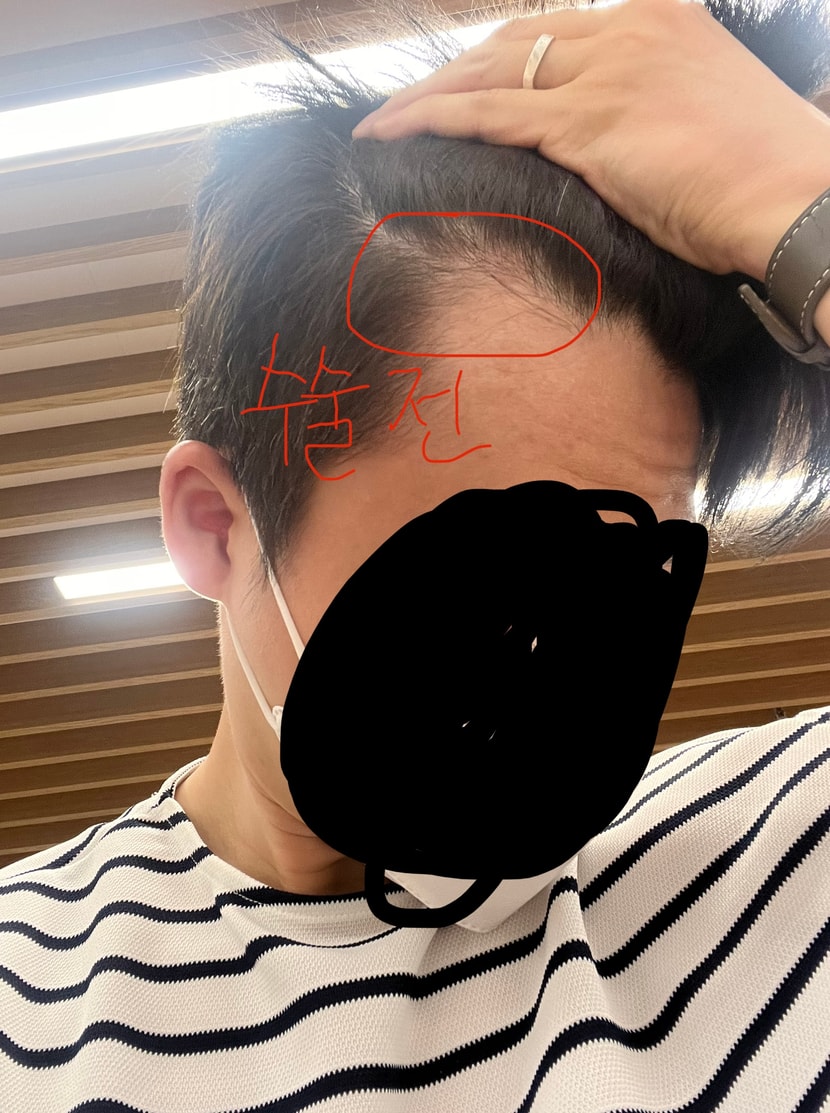 수술 전 사진