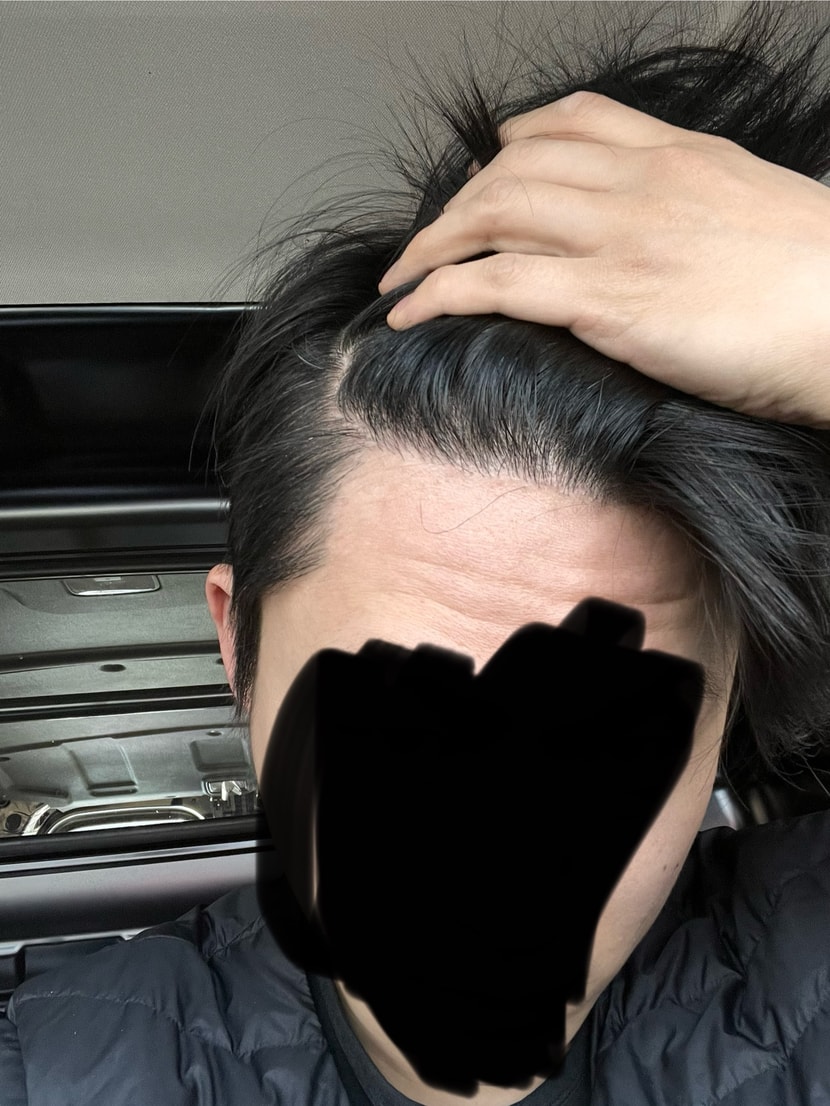 현재 (밀도가 없다고 생각드는 사진