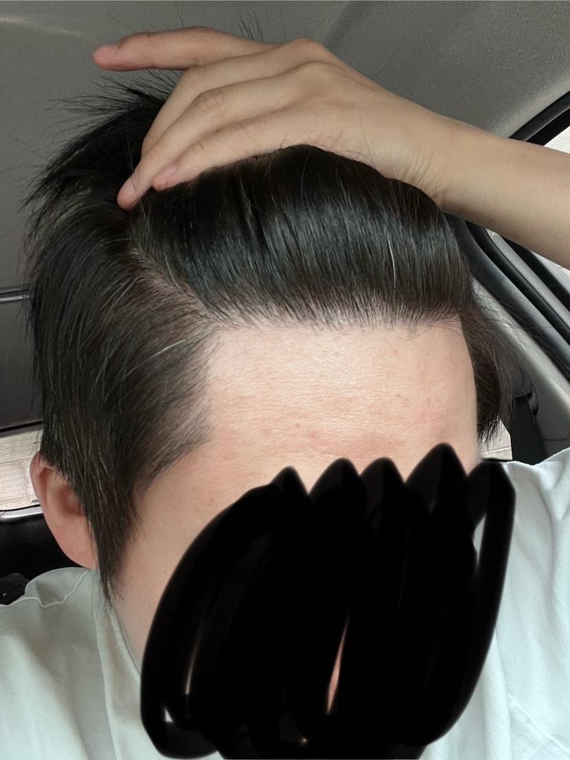 현재 (같은부분입니다. 각도가 다릅니다)