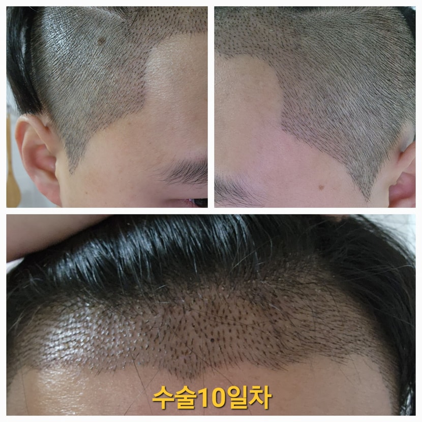10일차