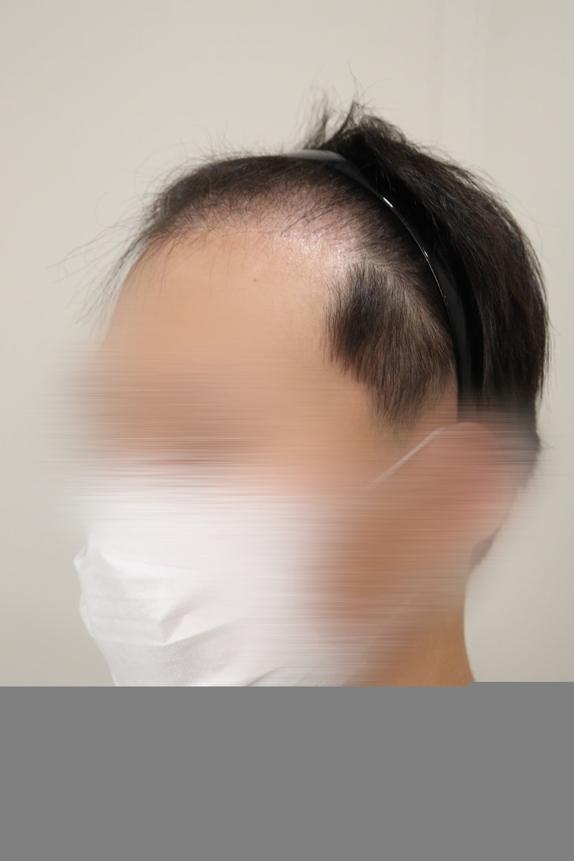 현재(2021.7)