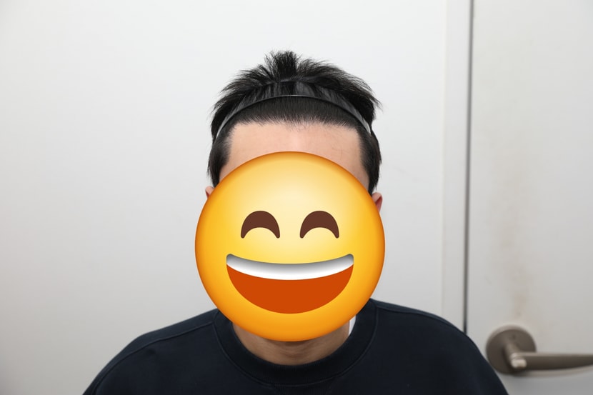 1년경과