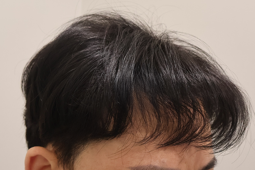 1년경과