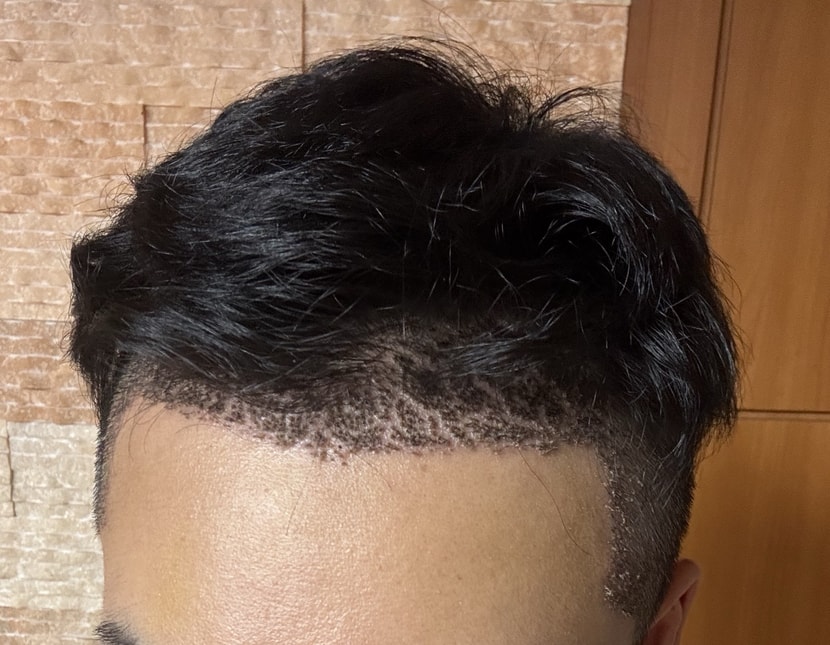 7일