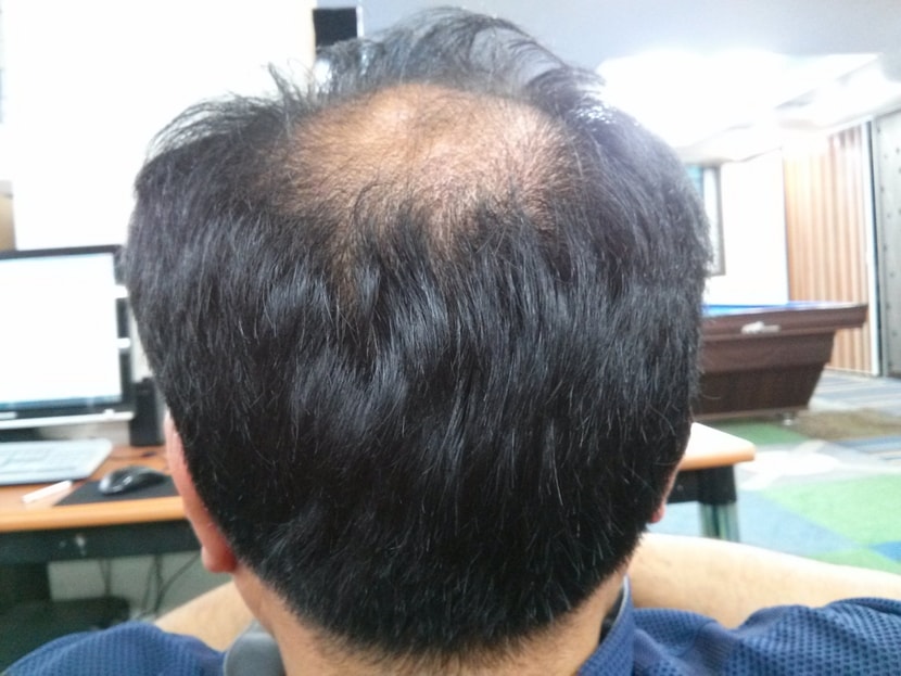뒤