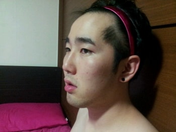 옆이마