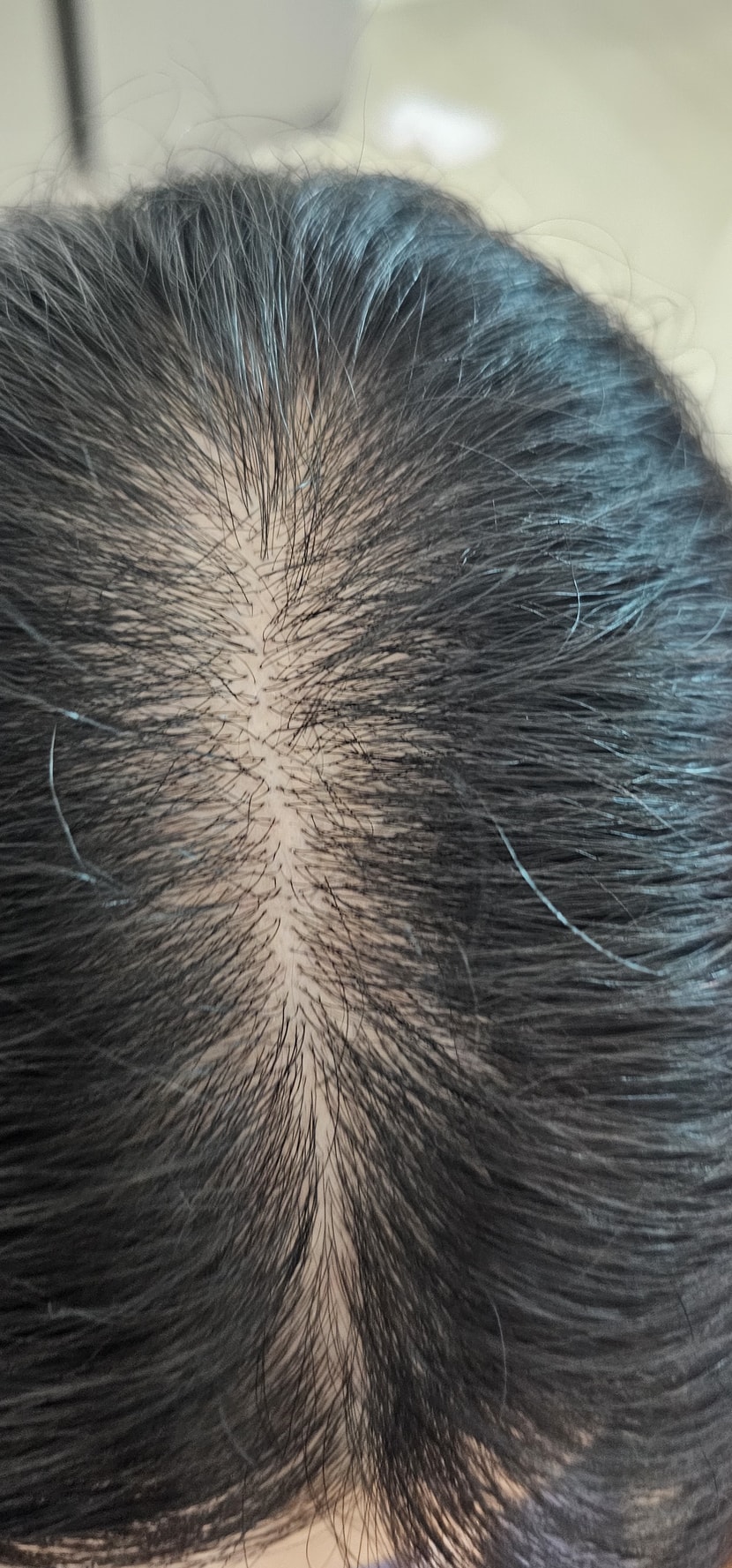 정수리 사진2