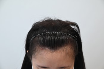 수술전