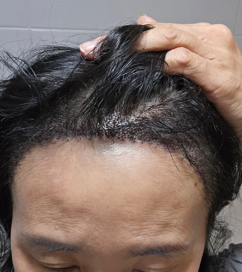 6일차 모습 이예요 ^^