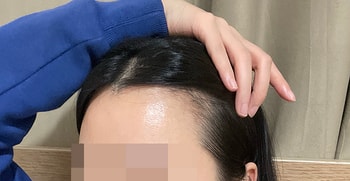 1개월 사진