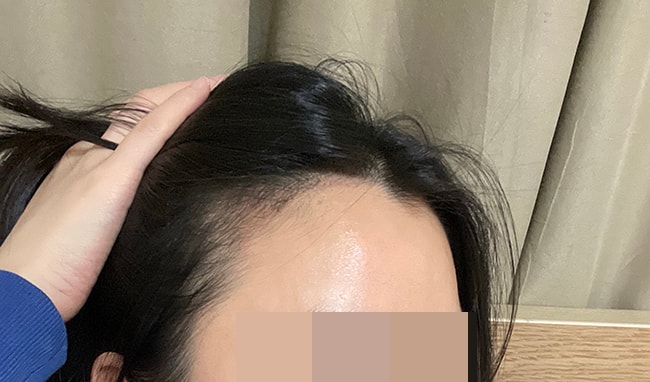 1개월 사진