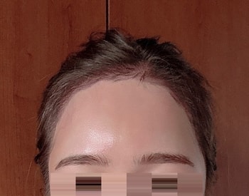 후