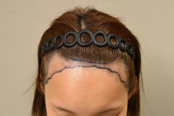 상담 및 헤어라인 디자인