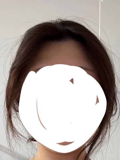 수술후