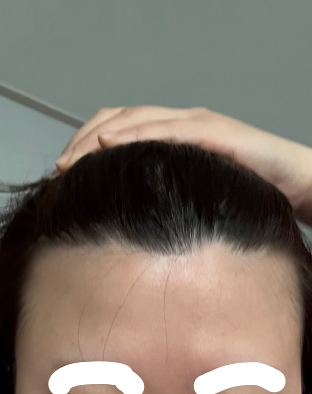 수술전 진짜 심각했뜸