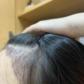 수술3일차