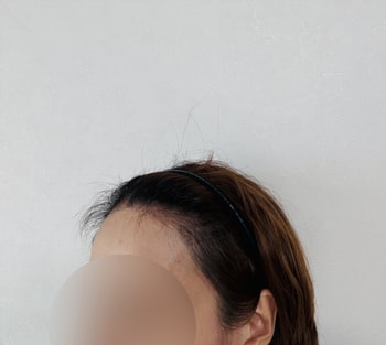 후