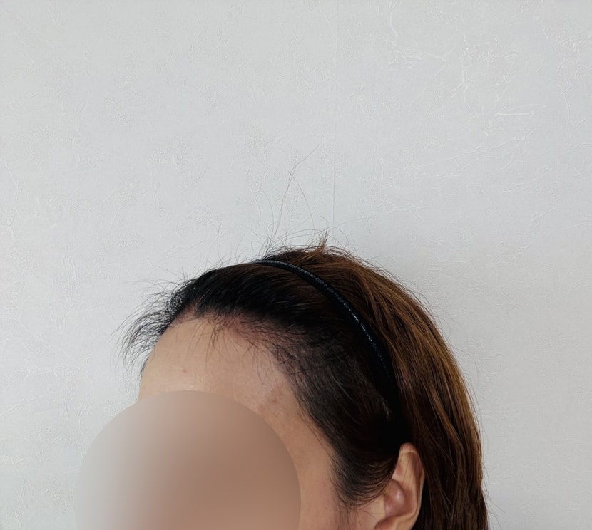 후