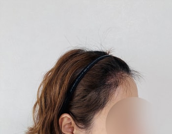 후