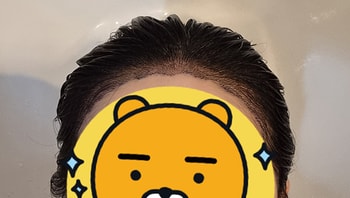 ﻿오늘 병원가서 샴푸받았어요