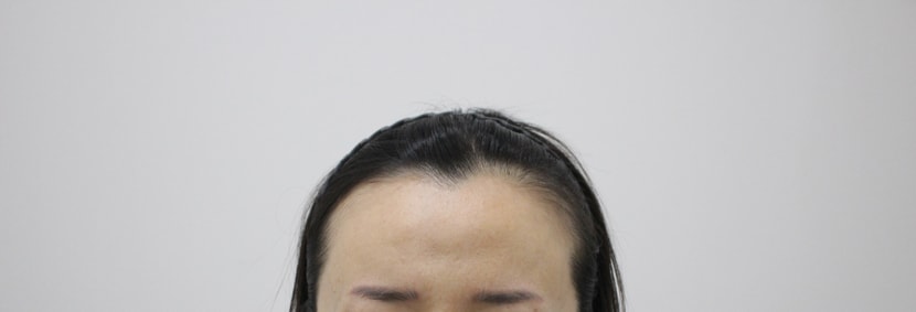 수술전