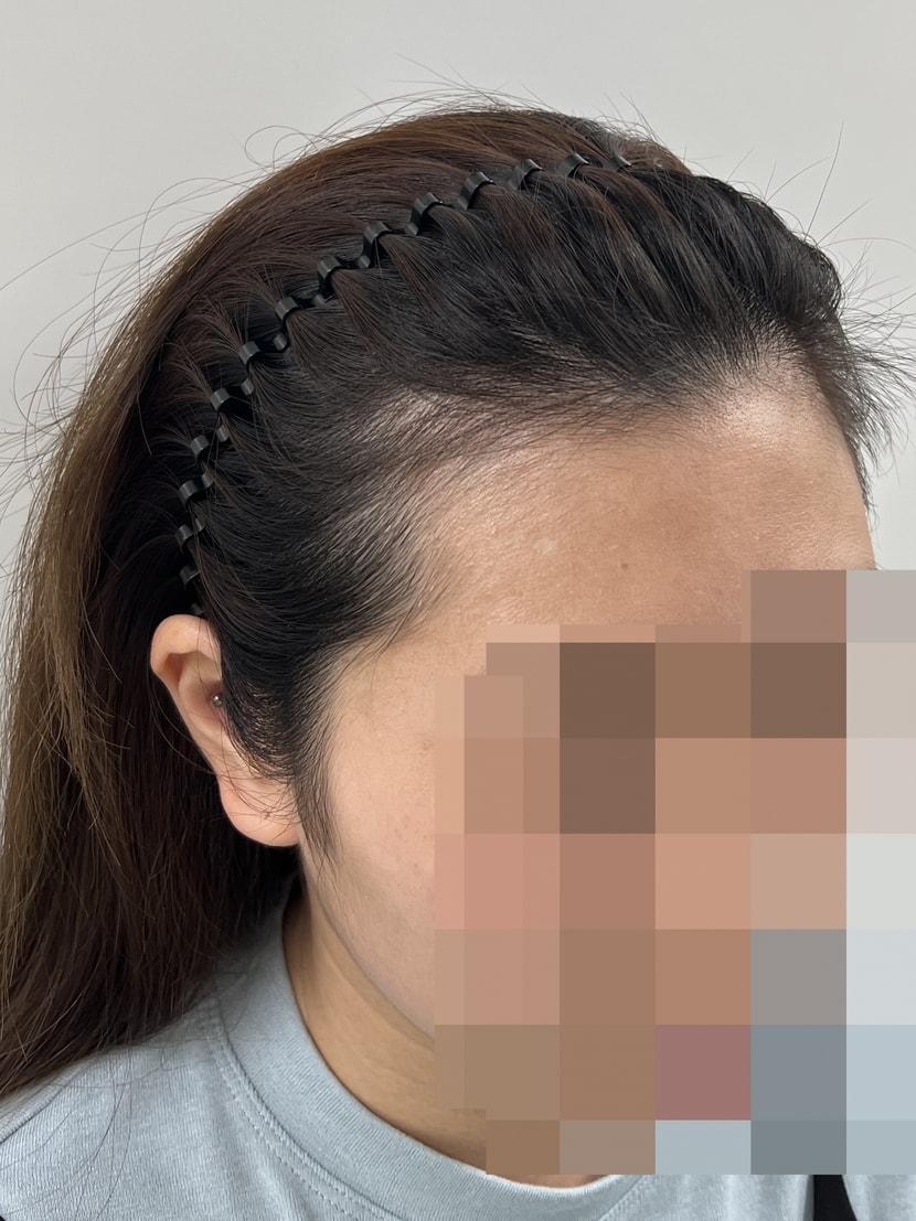 점점 흰살이 보이는 넓이가 넓어지고 있어요