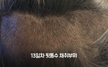 13일차