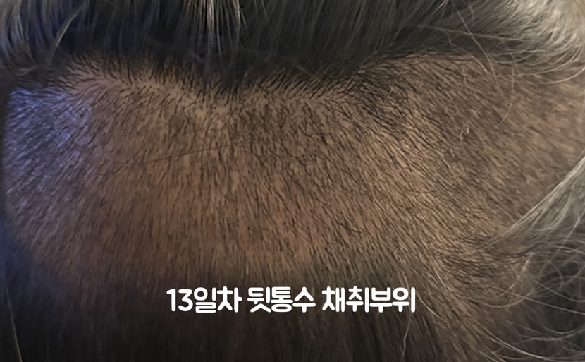 13일차