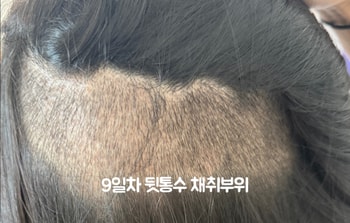 9일차