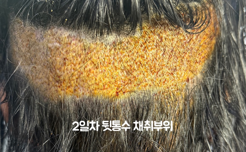 2일차