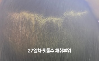 27일차