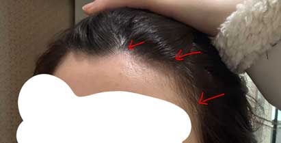 수술전에 특히 거슬렸던 부분들