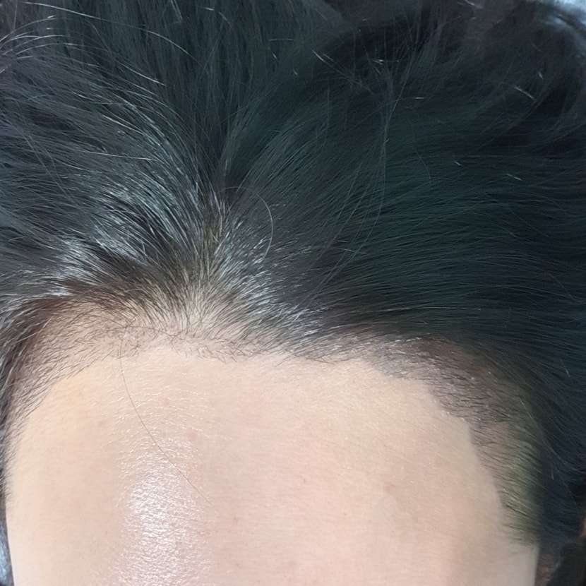 16일째