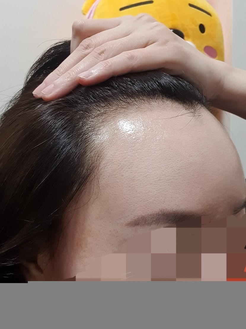 상담라인 수술당일