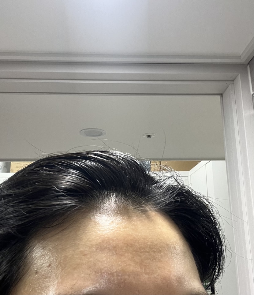 좌측
