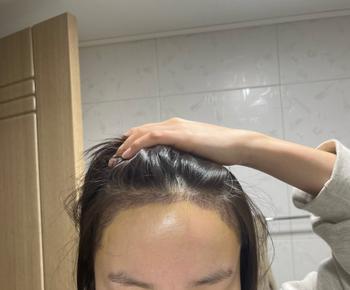 수술7일차
