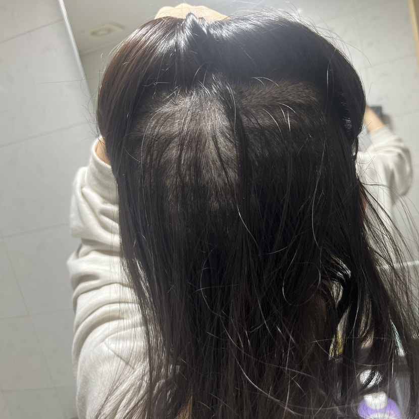 후두부 삭발 뒷모습