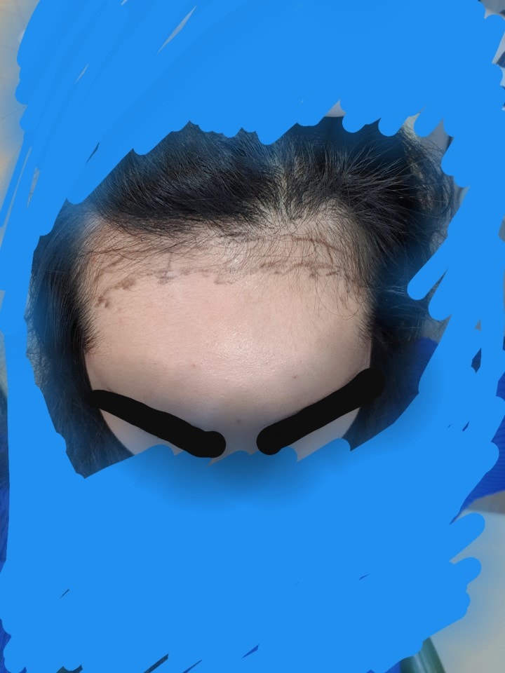 4ヶ所の相談を受けて来ました。