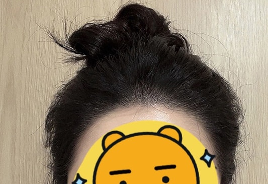 12월초에 찍은 셀카
