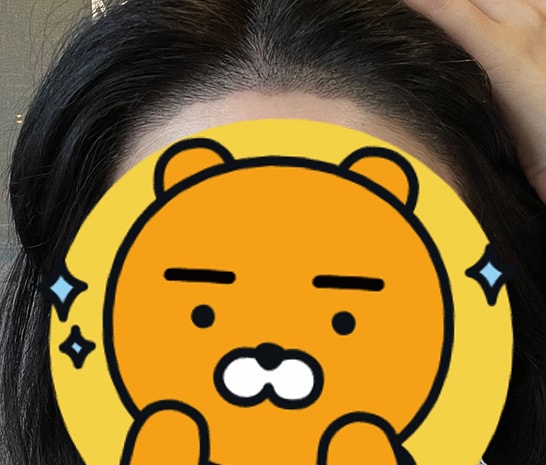 5/18 샴푸받고 찍어봤어요