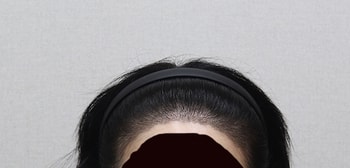 어제 병원에서 보내준 사진