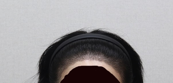 어제 병원에서 보내준 사진