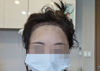 수술 끝나고 비니 쓰기 전