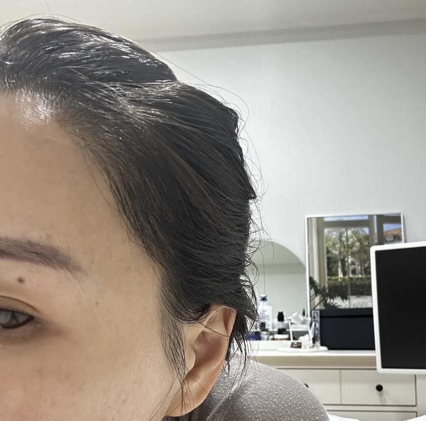 현재5개월후기 왼쪽 