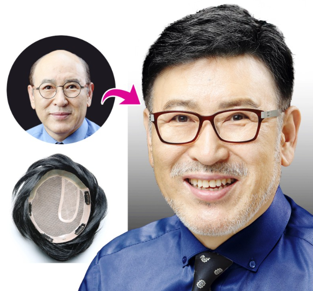 모슈에뜨 스탁가발