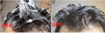 샴푸 전과 후 비교 (샴푸 후 머릿결이 살아있음) - 느낌이 아님