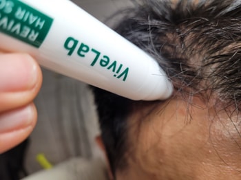 M자 라인 따라 두피앰플 바르기