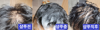샴푸전 - 샴푸중 - 샴푸후